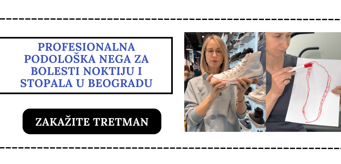 pregled podologa