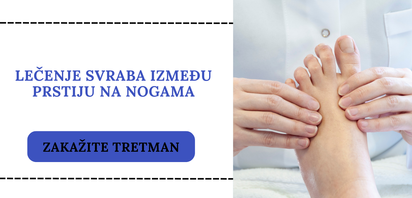 lecenje svraba izmedju prstiju na nogama