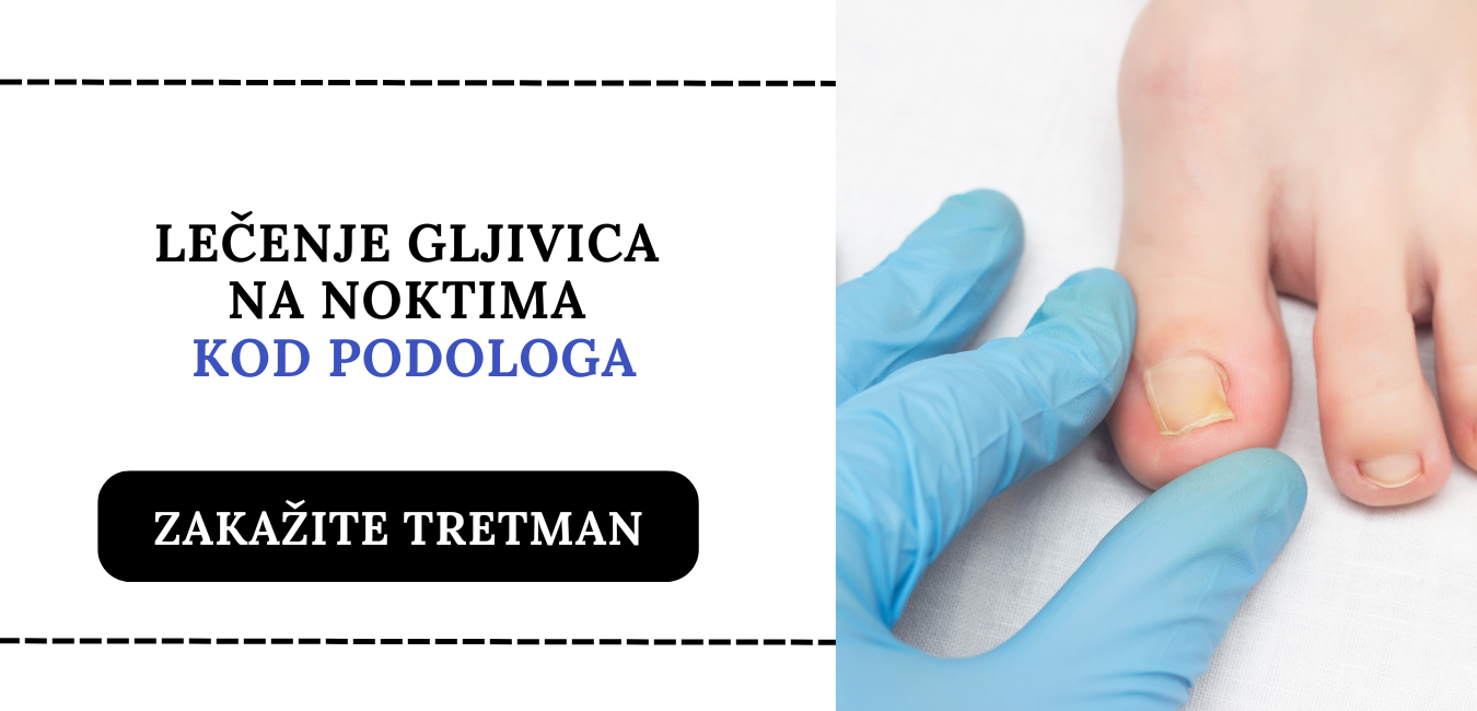 lecenje gljivica na noktima kod podologa